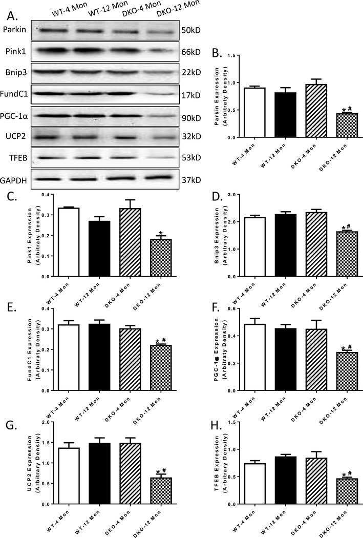 An external file that holds a picture, illustration, etc.
Object name is nihms-1503514-f0007.jpg