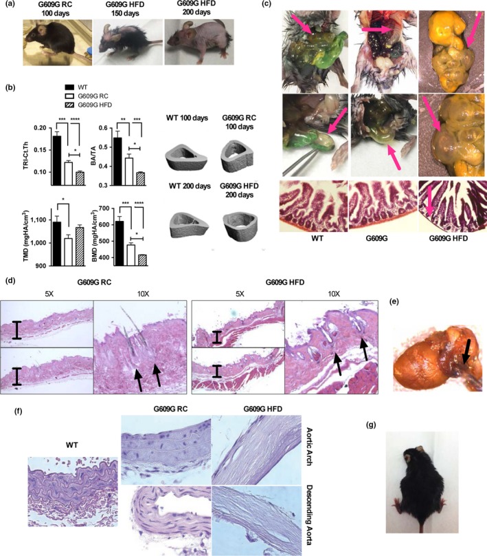 An external file that holds a picture, illustration, etc.
Object name is ACEL-18-e12852-g004.jpg